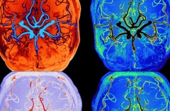 Scientists Watch Mind’s Self-Cleansing Course of Throughout Sleep in Actual Time